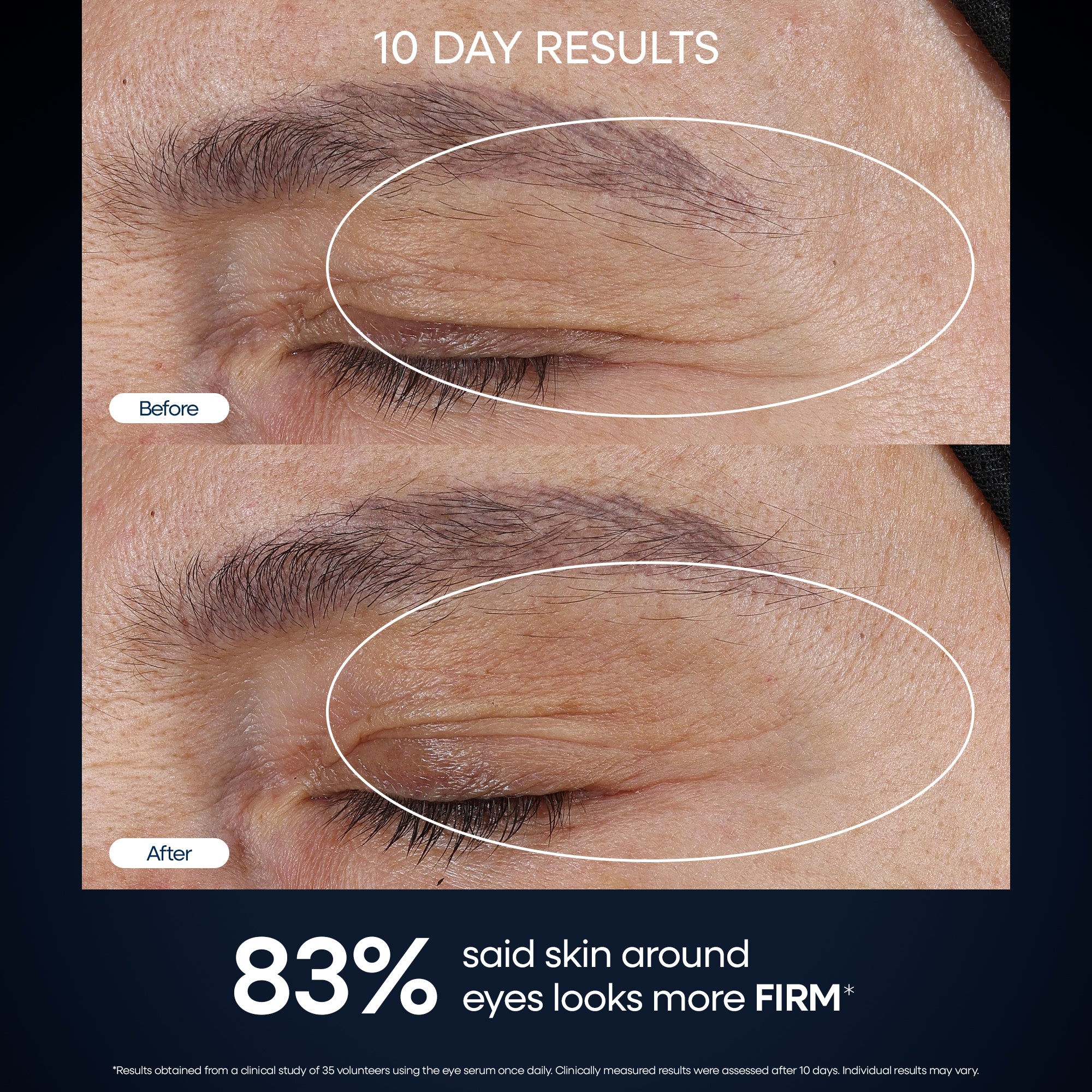 GENIUS Forever Firm Concentrated Face & Eye Serum Set