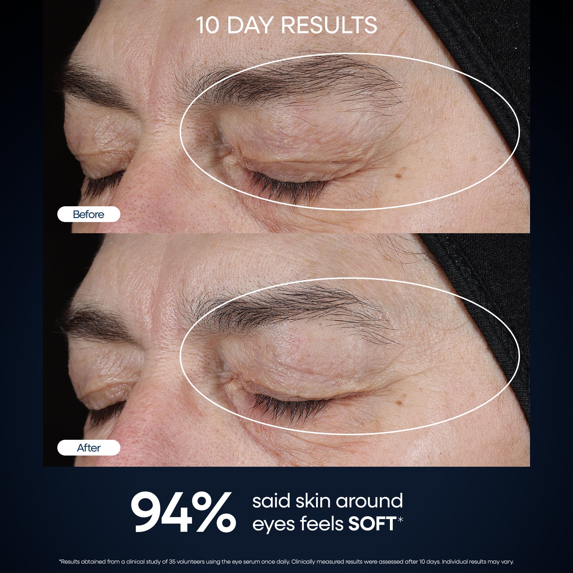 Genius Forever Firm Concentrated Eye Serum