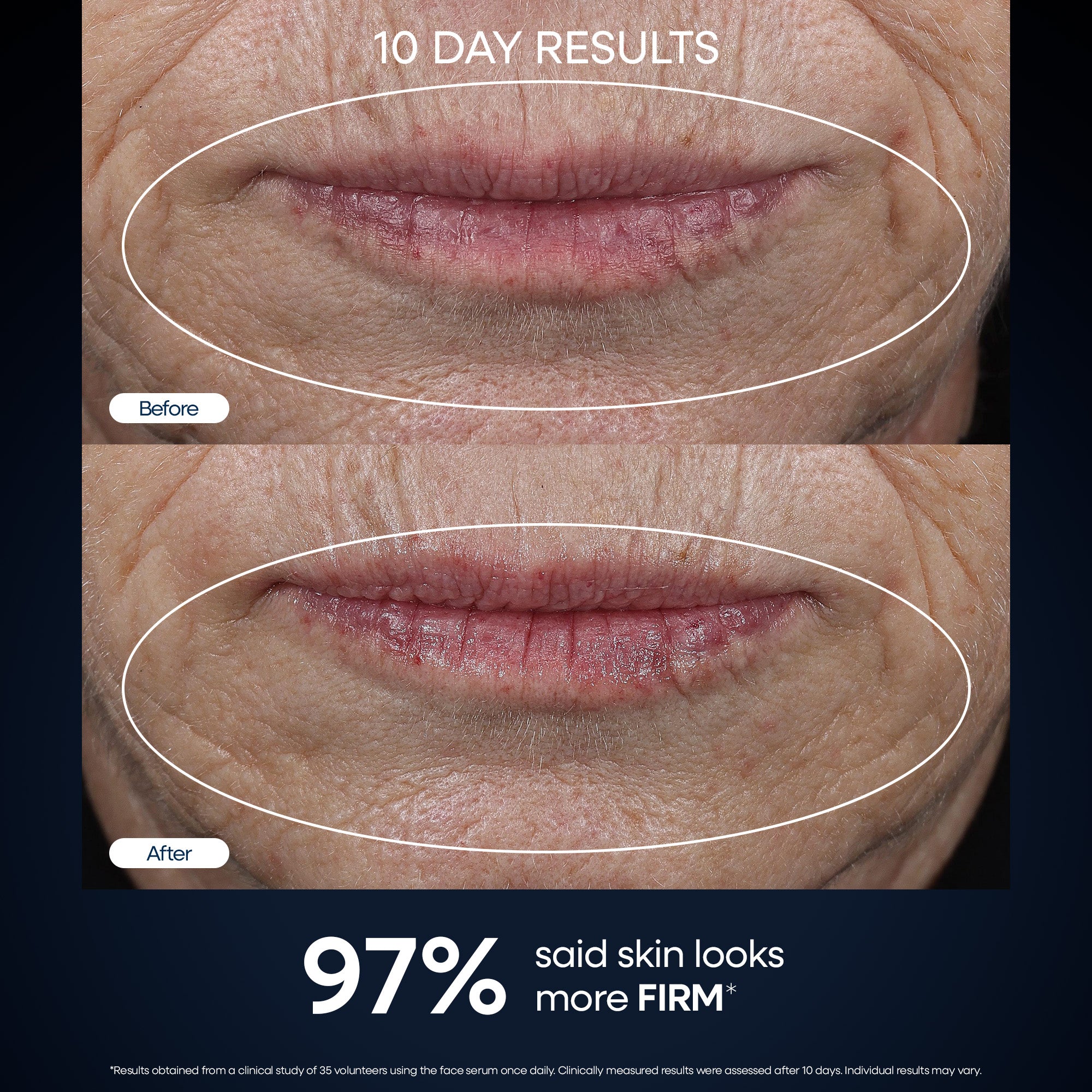 Genius Forever Firm Concentrated Face Serum