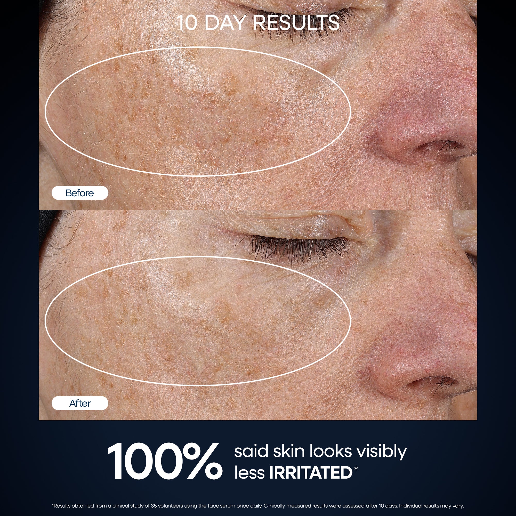 Genius Forever Firm Concentrated Face Serum