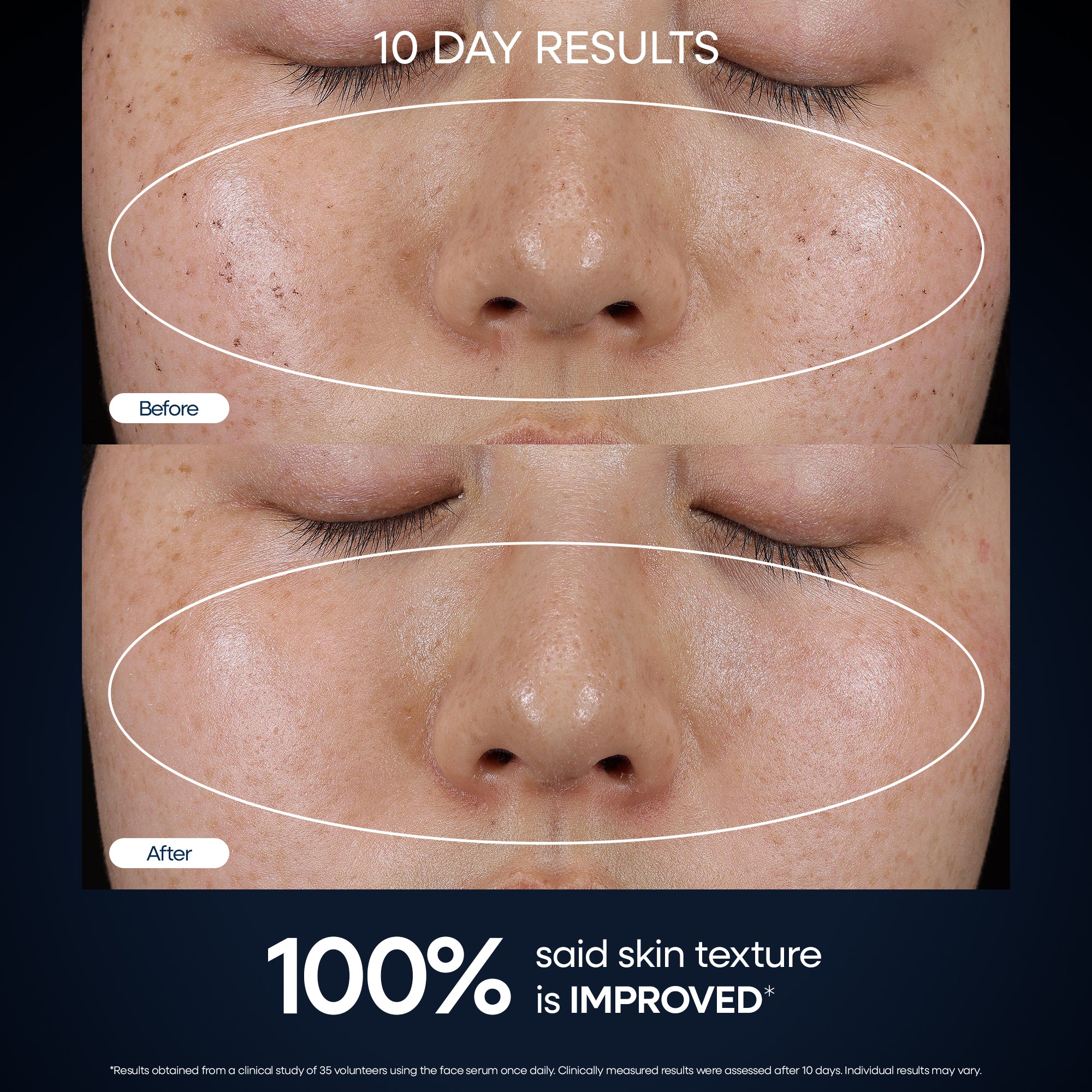 GENIUS Forever Firm Concentrated Face & Eye Serum Set