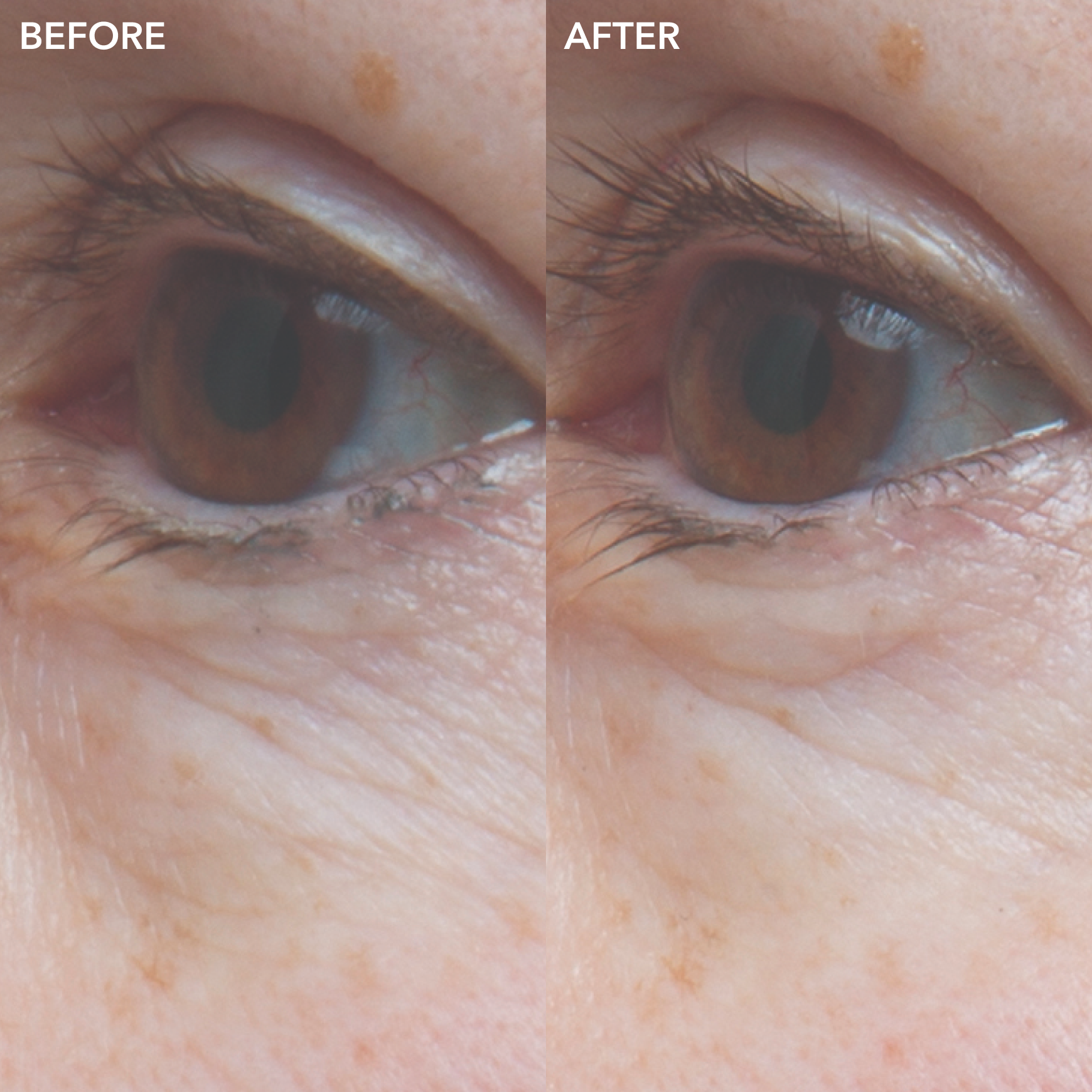 GENIUS Ultimate Anti-Aging Eye Cream