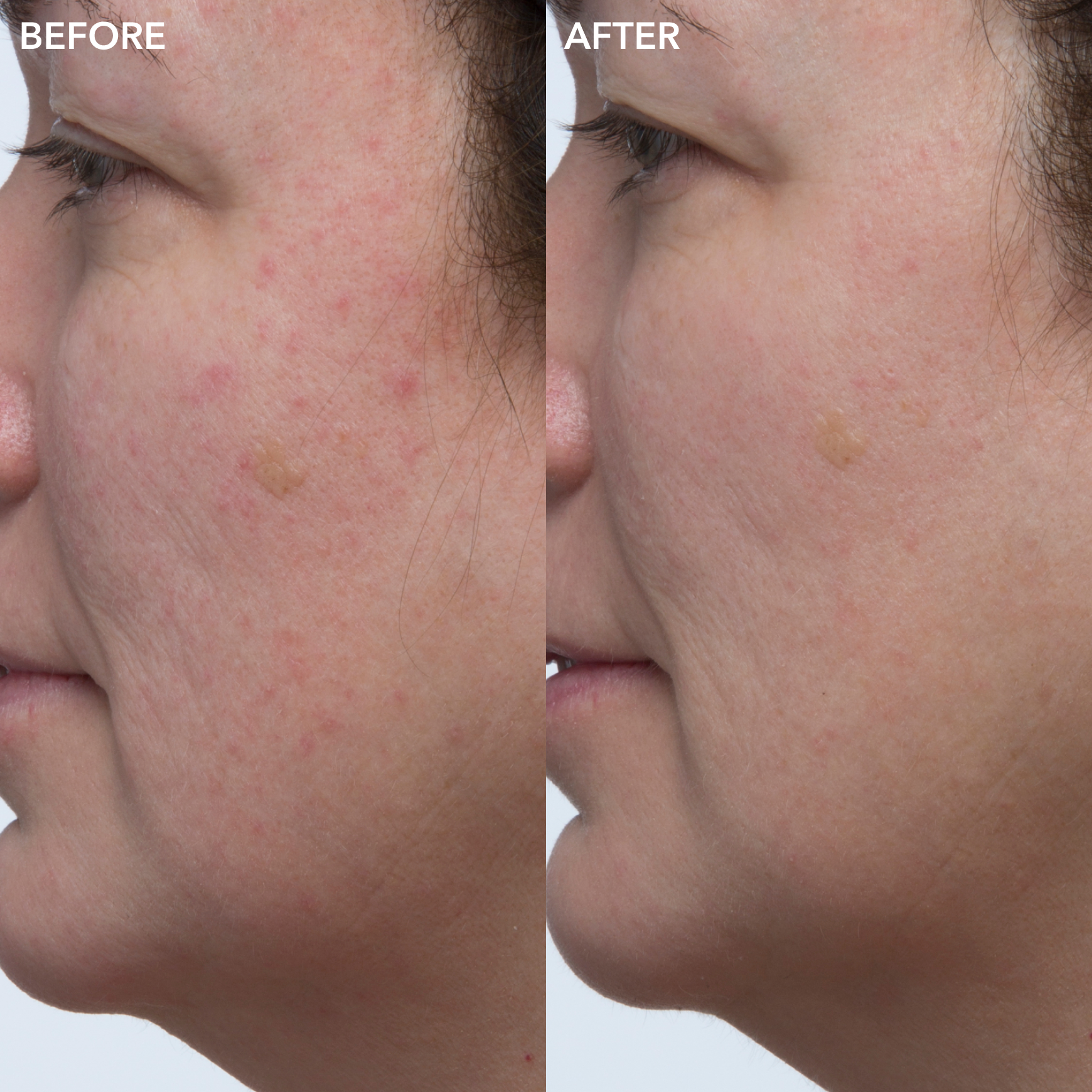 Green Microalgae Retinol + Regenerating Serum