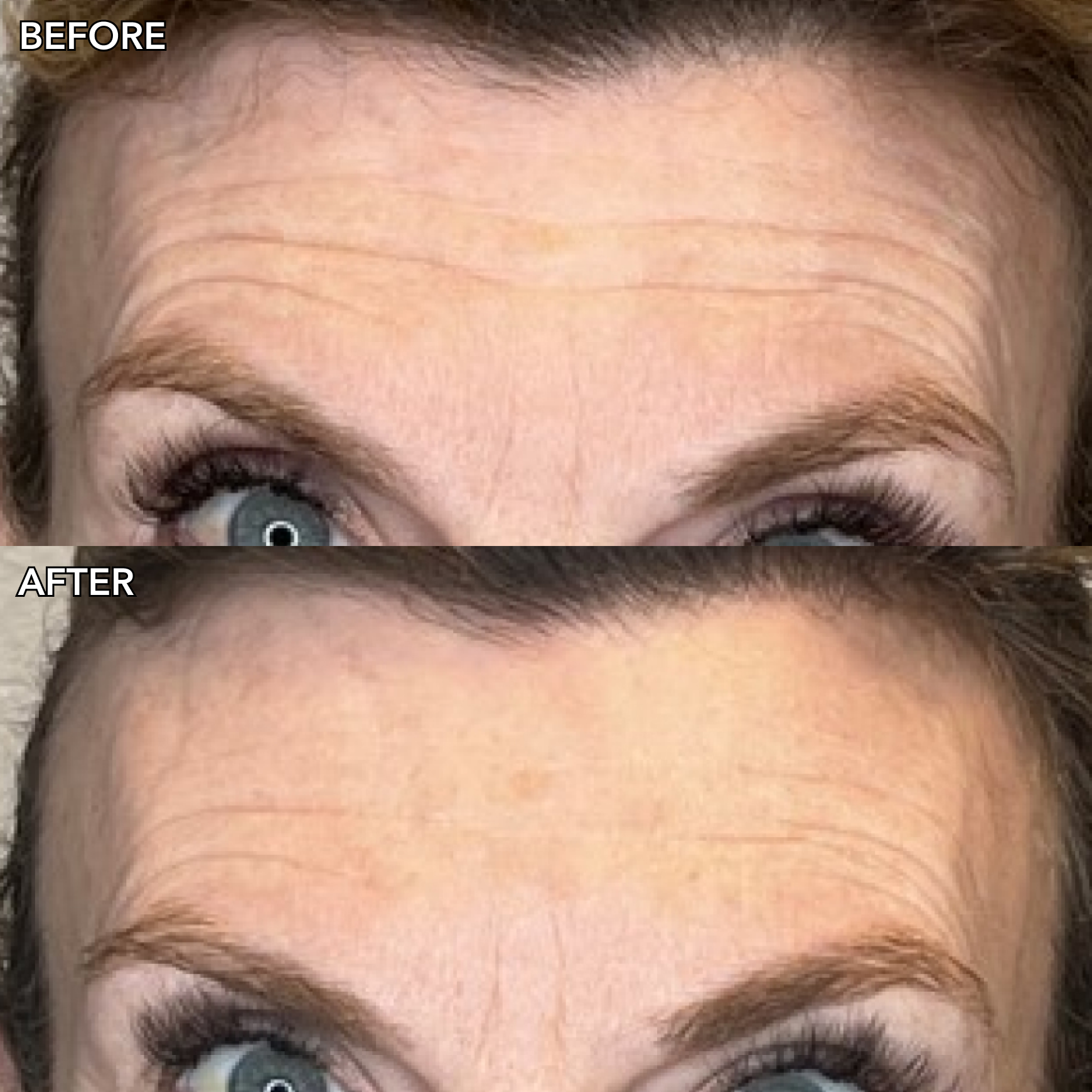 GENIUS Liquid Collagen 15ml® GWP