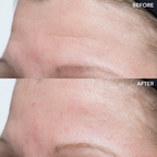 GENIUS Ultimate Anti-Aging Cream