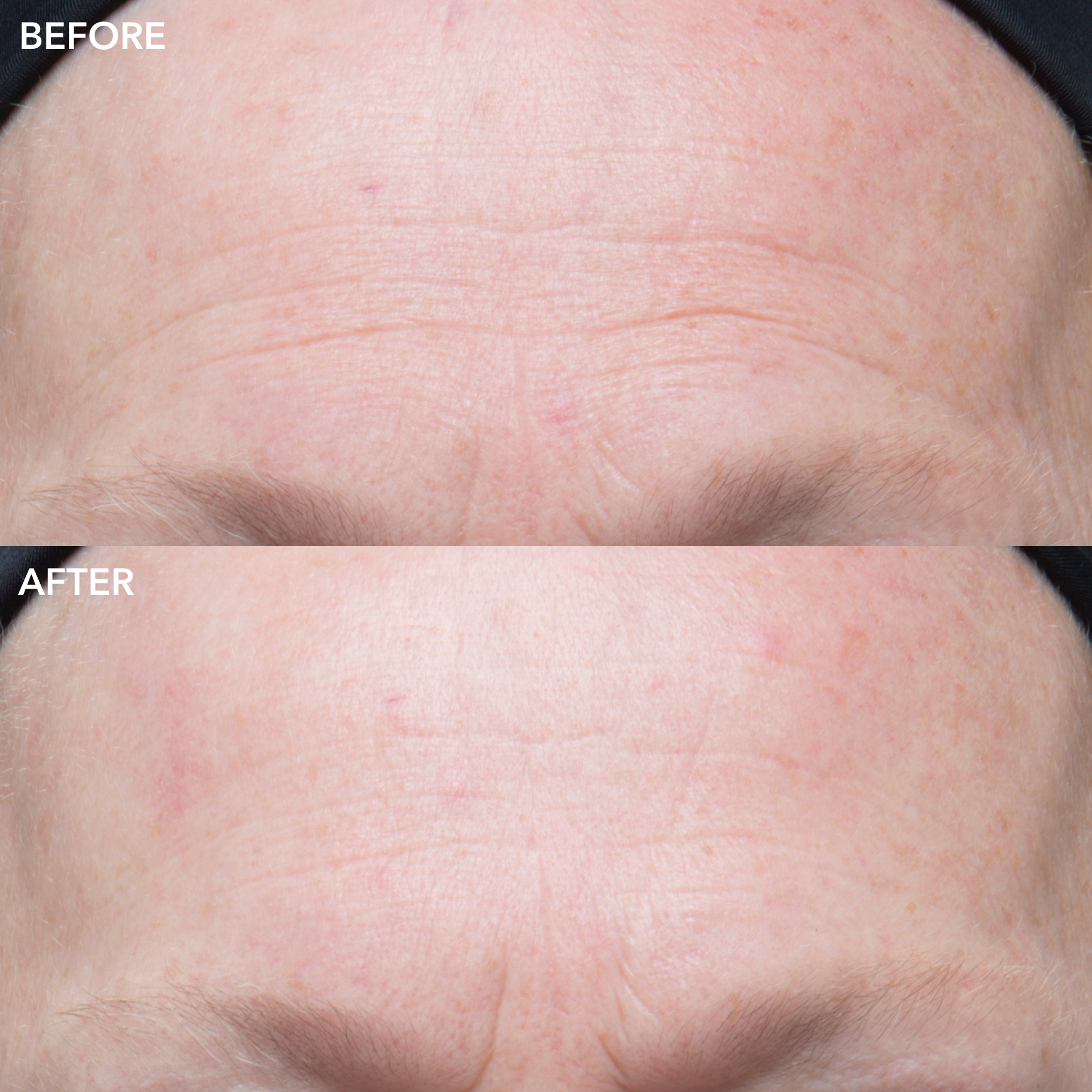 GENIUS Ultimate Anti-Aging Vitamin C+ Serum