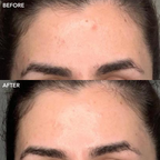 GENIUS Liquid Skin Resurfacing 2% BHA Toner