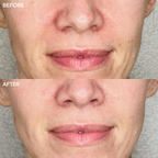 GENIUS Liquid Collagen® Essence