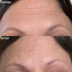 GENIUS Sleeping Collagen®