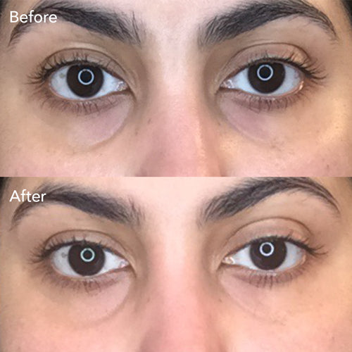 Triple Algae Eye Renewal Balm