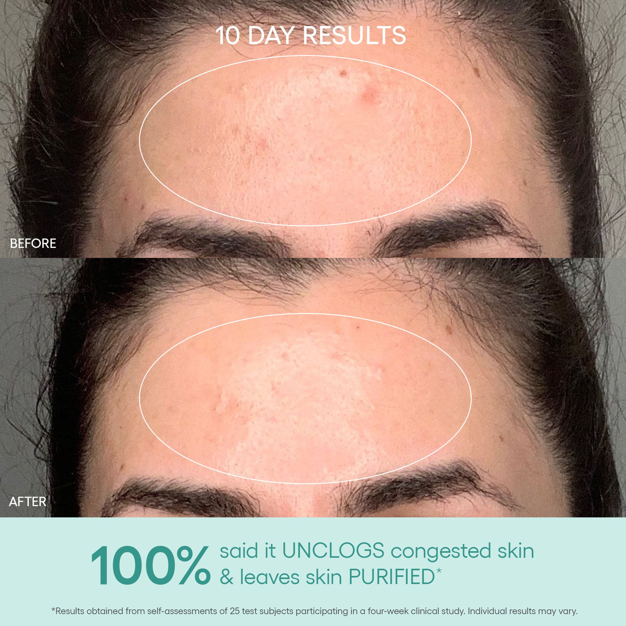 GENIUS Liquid Skin Resurfacing 2% BHA Toner