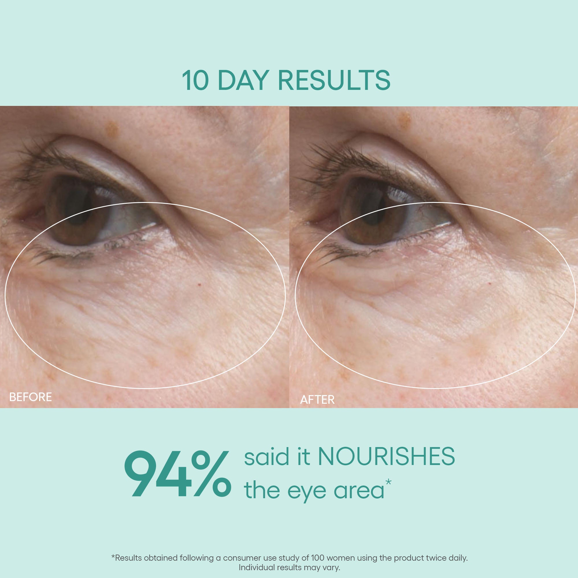 GENIUS Ultimate Anti-Aging Eye Cream