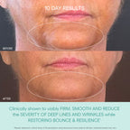 GENIUS Liquid Collagen®