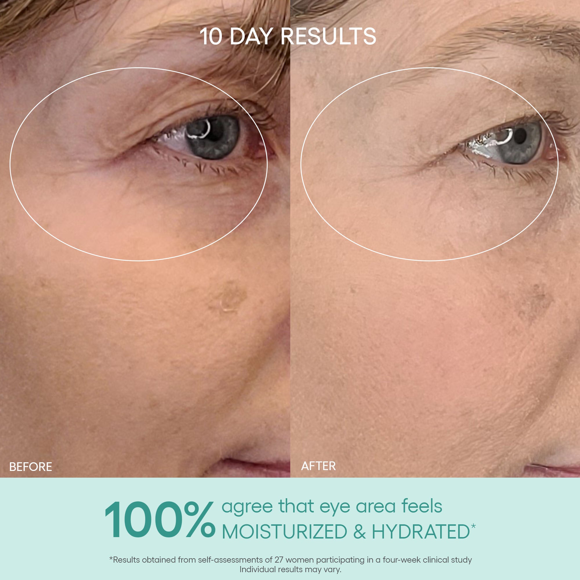 Triple Algae Eye Renewal Balm – Reduce Dark Circles & Puffiness