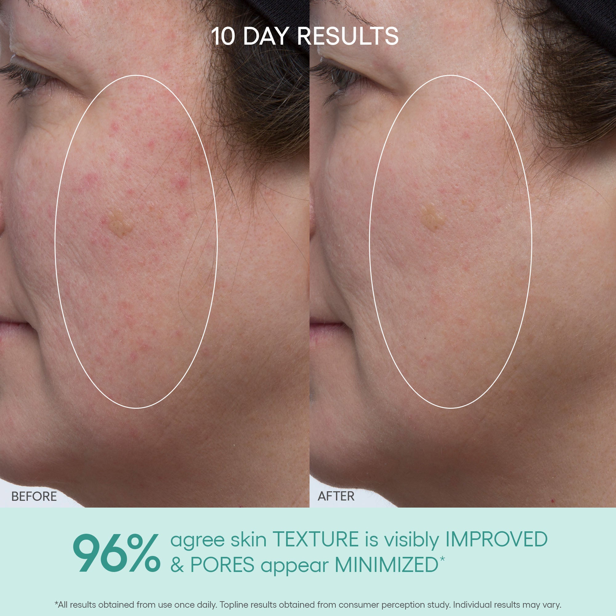 GREEN MICROALGAE RETINOL + Regenerating Serum