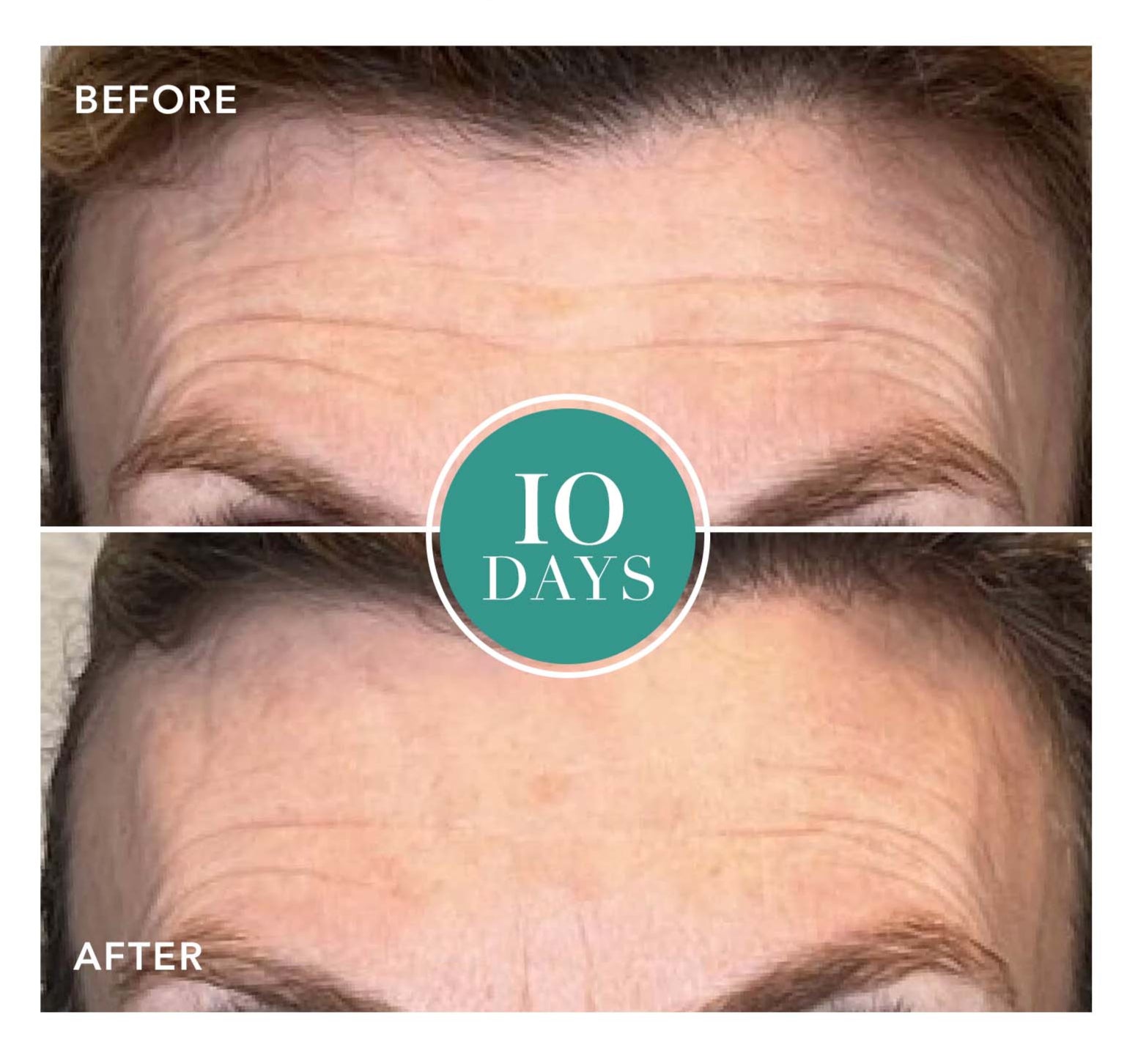 GENIUS Liquid Collagen®