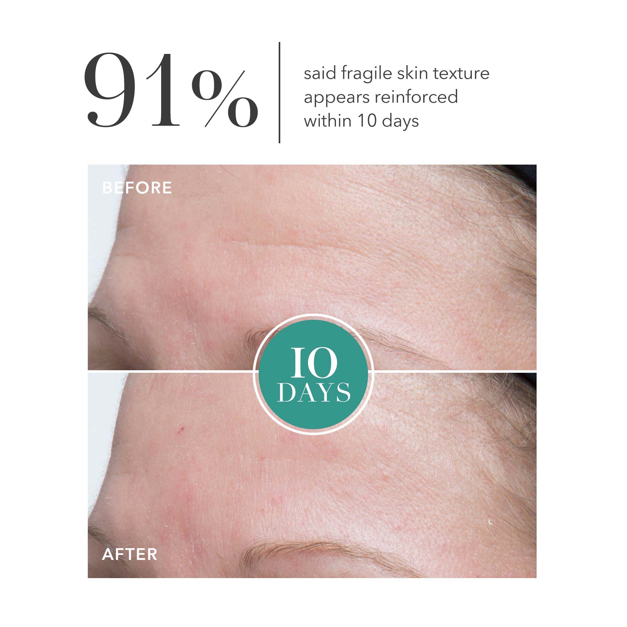 GENIUS Ultimate Anti-Aging Cream 30ML GWP